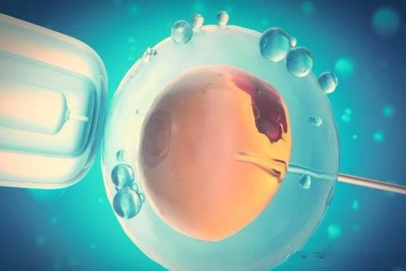 供卵试管婴儿选性别包成功【供卵试管婴儿选性别包成功:实现你梦寐以求的宝宝性别】