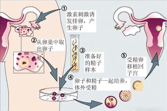 供卵机构是真的吗-供卵机构是真的吗?揭秘供卵机构的真相