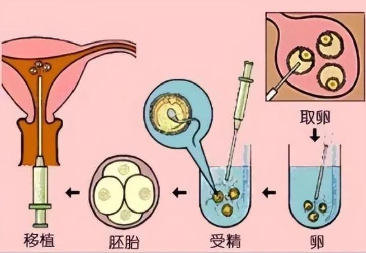 供卵生出来的宝宝有自己的基因吗【供卵生出的宝宝是否具有自己的基因?】