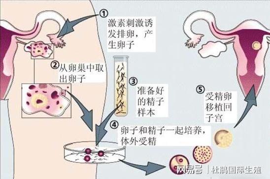 供卵的孩子跟母体有血缘关系吗【供卵孩子与母体是否有血缘关系?】