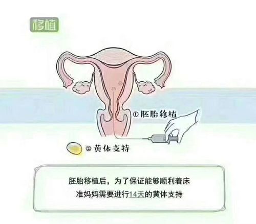 借卵试管代怀产子过程_借卵试管代怀产子:新生命的奇迹过程